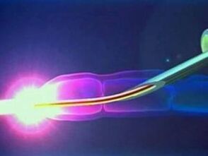 Laser al lavoro